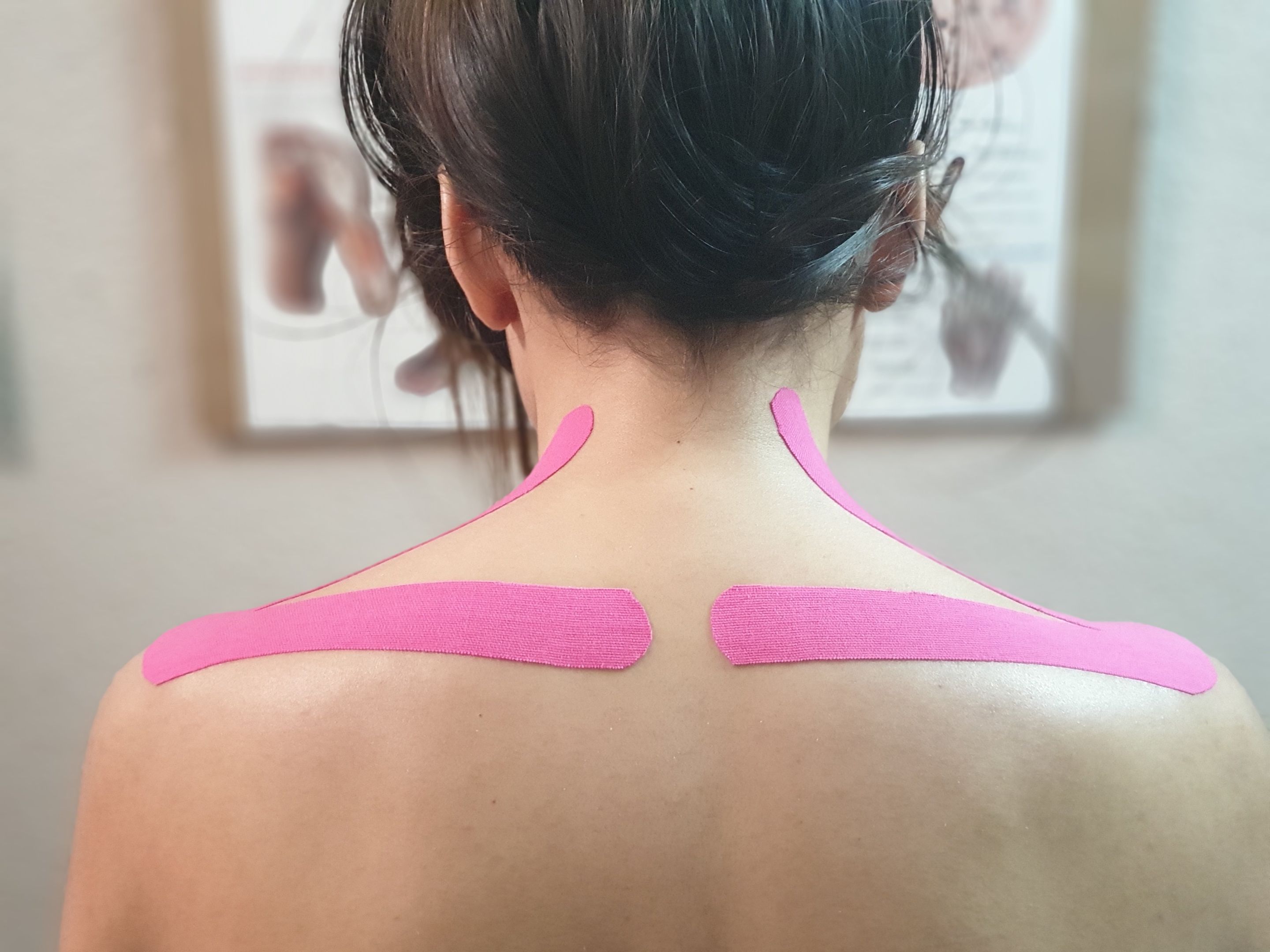 Kinesiotaping